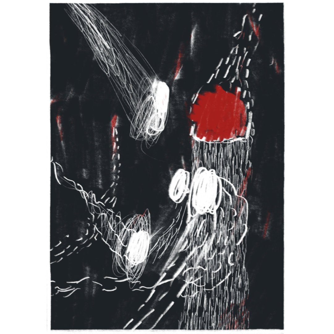 Cataract-7